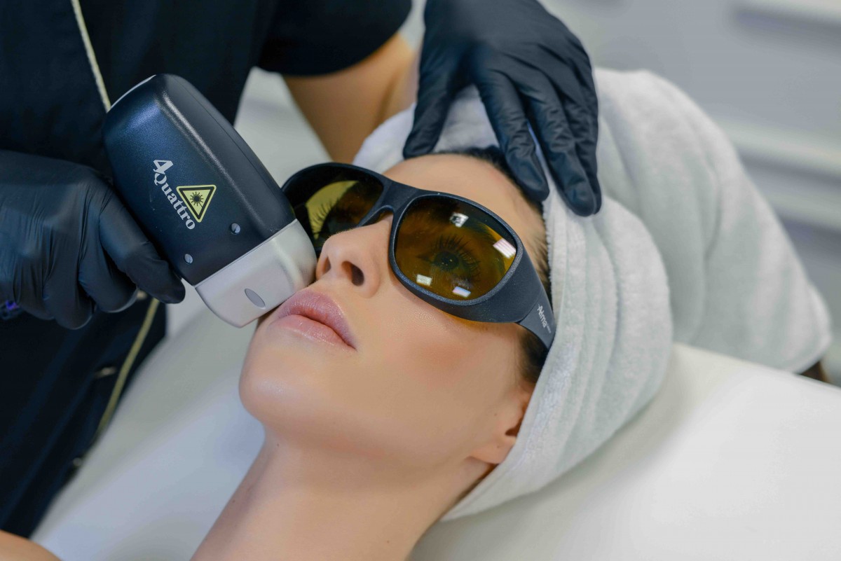 4 benefits of laser hair removal with Soprano Titanium